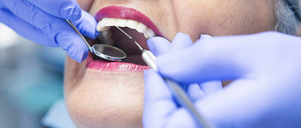 Best Mobile Emergency Dentist in Hagerstown, IN