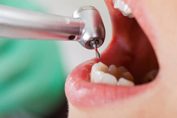 Best Emergency Cosmetic Dentistry in Hagerstown, IN